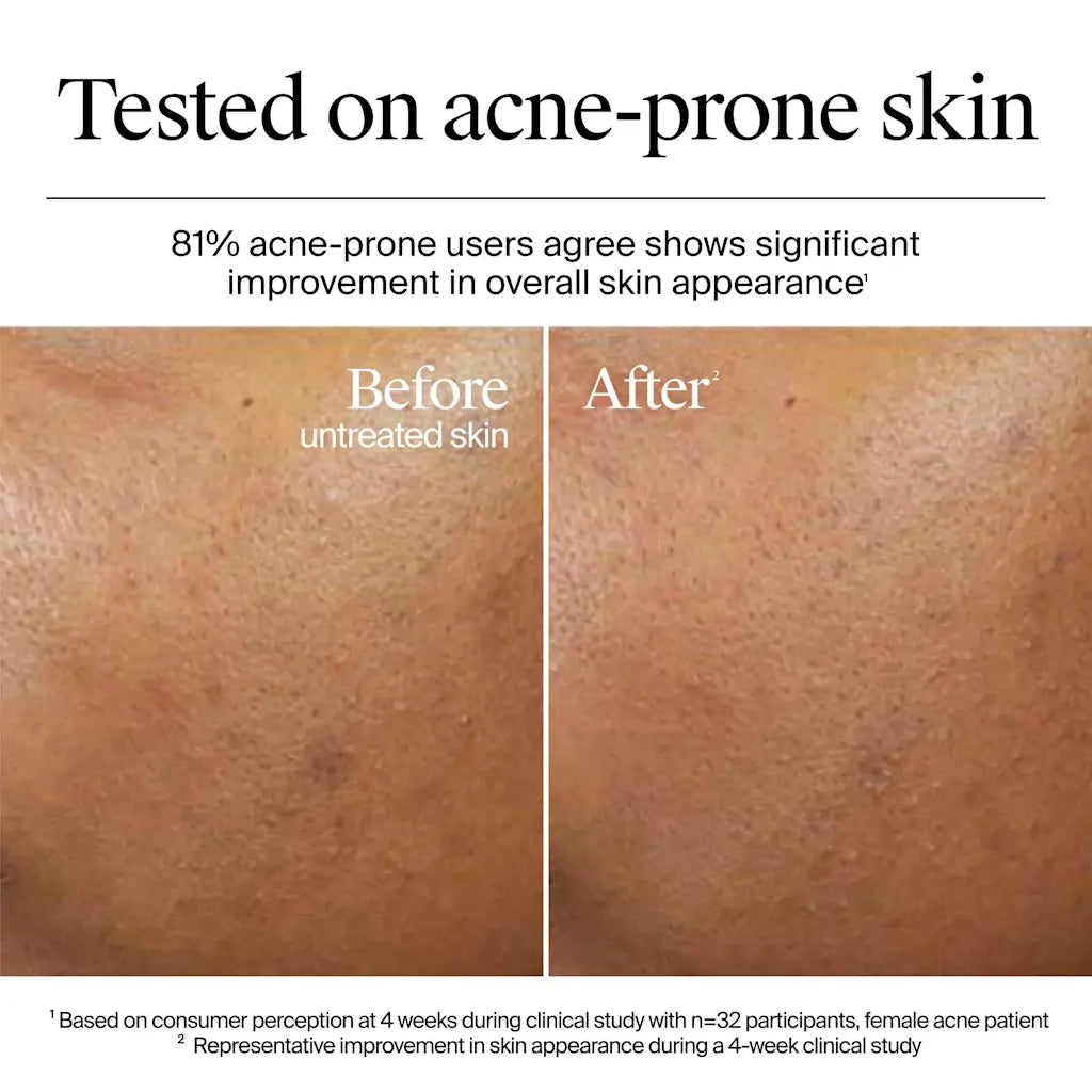 Neutrogena Hydro Boost Water Gel (50ml) – Daily Hydrating Face Moisturizer