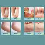 Ansiyi - Foot Bacteria Bacteriostasis Spray